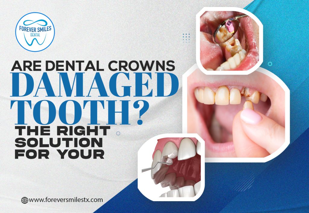Are Dental Crowns the Right Solution for Your Damaged Tooth?