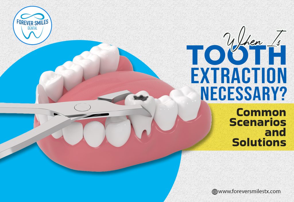 When Is Tooth Extraction Necessary? Common Scenarios and Solutions