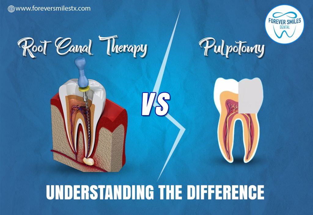 Root Canal Therapy vs. Pulpotomy: Understanding the Difference
