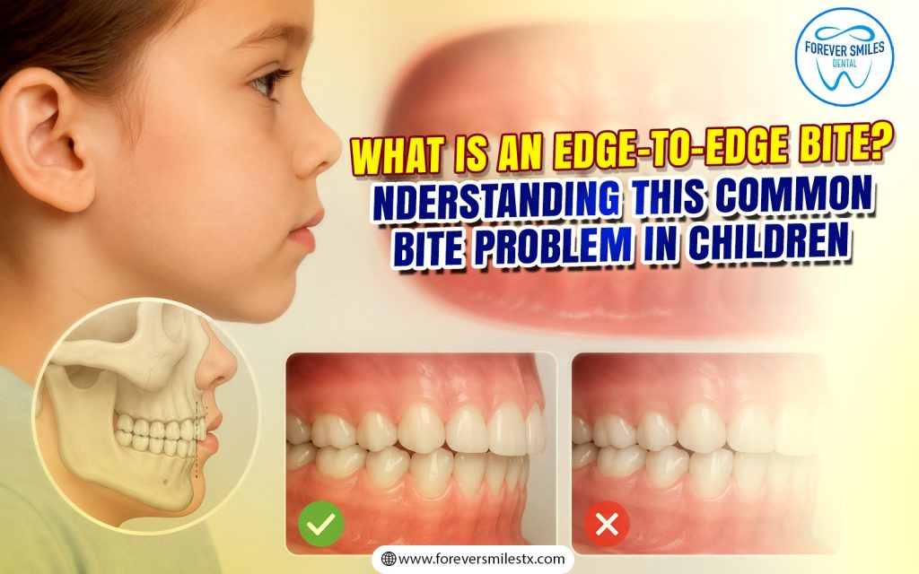 What Is an Edge-to-Edge Bite? Understanding This Common Bite Problem in Children